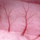 Rat intestinal microcirculation