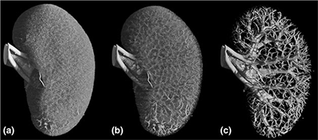 Intercellular communication in the kidney