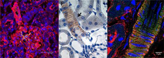 Ion channels in the renal vasculature