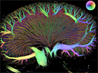 Structure of the renal vasculature