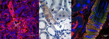 Ion channels in the renal vasculature