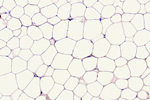 Adipose tissue