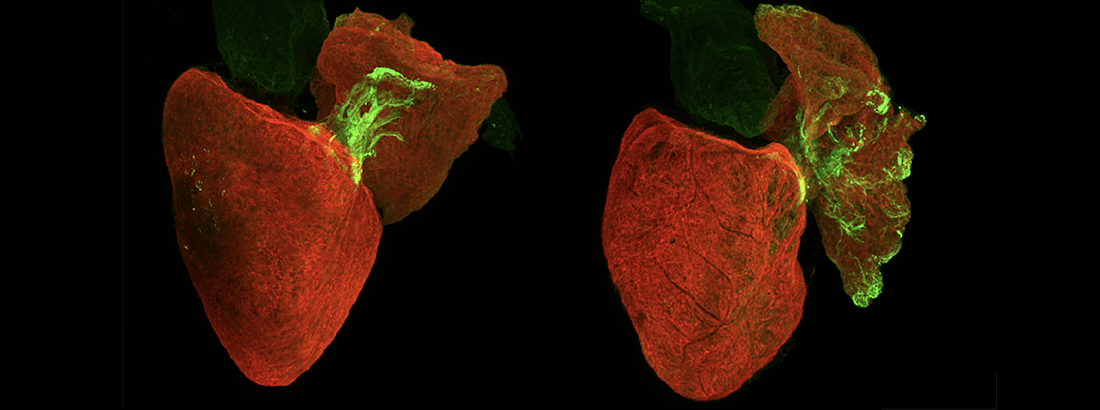 Zebrafish hearts, where the heart muscle is marked in red, and the conduction system in green.